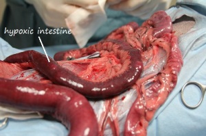 7___hypoxic_intestine